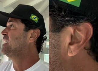 Um detalhe na orelha pode indicar risco cardíaco? O sinal que voltou à tona após a morte de Maderite