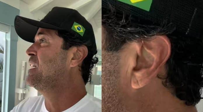 Um detalhe na orelha pode indicar risco cardíaco? O sinal que voltou à tona após a morte de Maderite