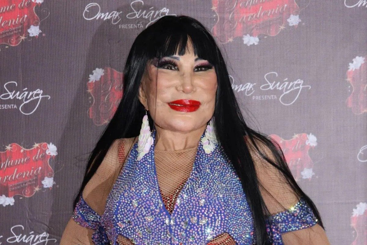 contioutra.com - Ela estrelou quase 100 filmes, mas um procedimento est&eacute;tico mudou seu rosto de forma irrevers&iacute;vel
