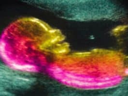 Cientistas podem ter descoberto uma das causas do autismo