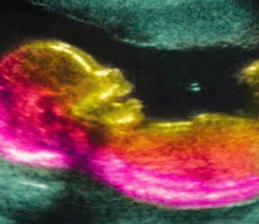 Cientistas podem ter descoberto uma das causas do autismo