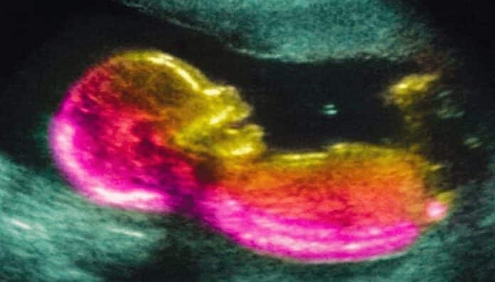 Novo estudo liga autismo a fator inesperado durante a gestação e levanta alerta