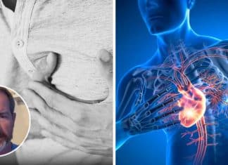 Esses 4 alimentos estão no seu prato — e um cirurgião cardíaco diz que você deveria evitar todos