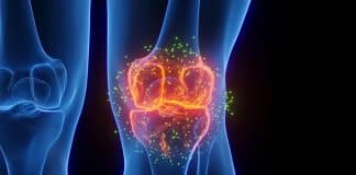 Nova injeção faz cartilagem do joelho voltar a crescer em meses e pode mudar o tratamento da artrite