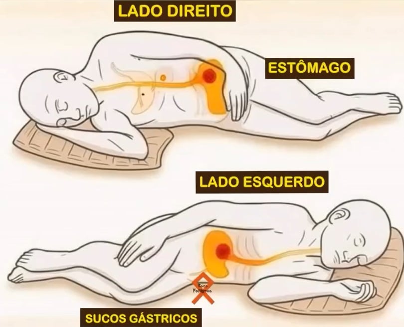 Você dorme desse lado todas as noites? Médicos alertam que essa posição pode prejudicar digestão e respiração contioutra.com - Você dorme desse lado todas as noites? Médicos alertam que essa posição pode prejudicar digestão e respiração