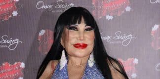 Ela estrelou quase 100 filmes, mas um procedimento estético mudou seu rosto de forma irreversível