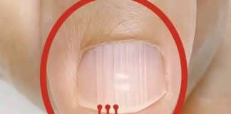 Essas linhas nas unhas depois dos 40 podem dizer mais sobre sua saúde do que você imagina