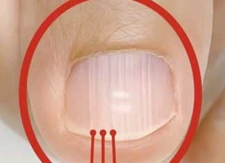 Essas linhas nas unhas depois dos 40 podem dizer mais sobre sua saúde do que você imagina
