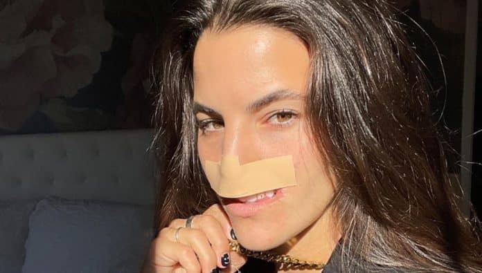 Ataque de pitbull mudou o rosto de modelo — anos depois, ela revela resultado da reconstrução