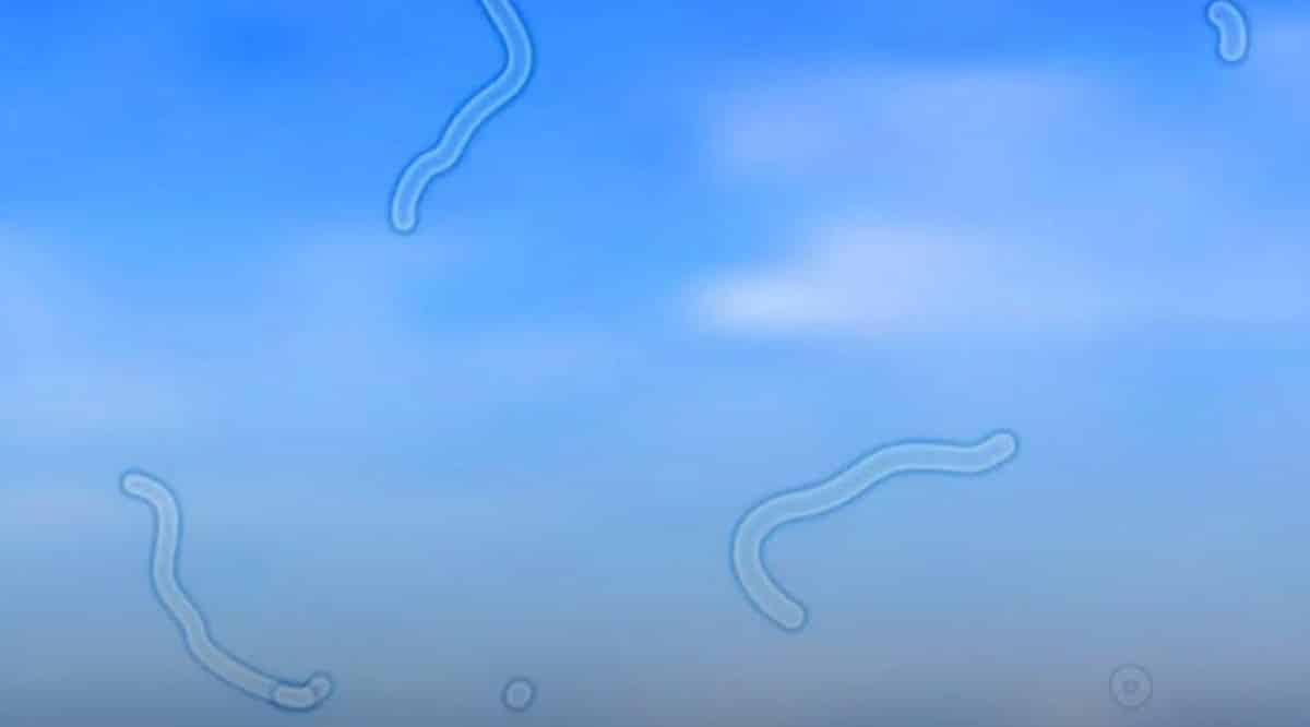 Esses pontinhos na visão podem não ser tão inofensivos: o que um oftalmologista recomenda fazer agora contioutra.com - Esses pontinhos na visão podem não ser tão inofensivos: o que um oftalmologista recomenda fazer agora