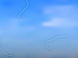 oftalmologista explica o que você deve fazer se começar a ver moscas flutuantes