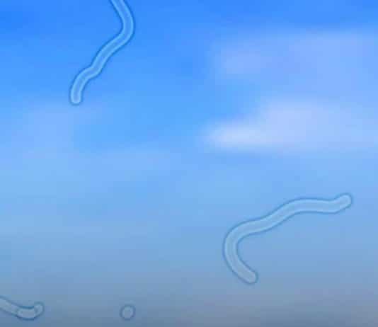 oftalmologista explica o que você deve fazer se começar a ver moscas flutuantes