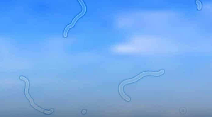 oftalmologista explica o que você deve fazer se começar a ver moscas flutuantes Esses pontinhos na visão podem não ser tão inofensivos: o que um oftalmologista recomenda fazer agora