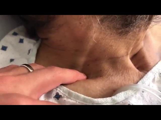 contioutra.com - Sinal cl&iacute;nico revelador sobre a sa&uacute;de: As consequ&ecirc;ncias do ingurgitamento jugular