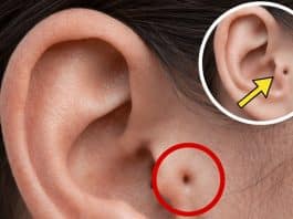 Conhece alguém com esta marca na orelha? O que ela revela pode mudar como você vê essa pessoa Conhece alguém com esta marca na orelha