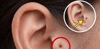 Conhece alguém com esta marca na orelha? O que ela revela pode mudar como você vê essa pessoa
