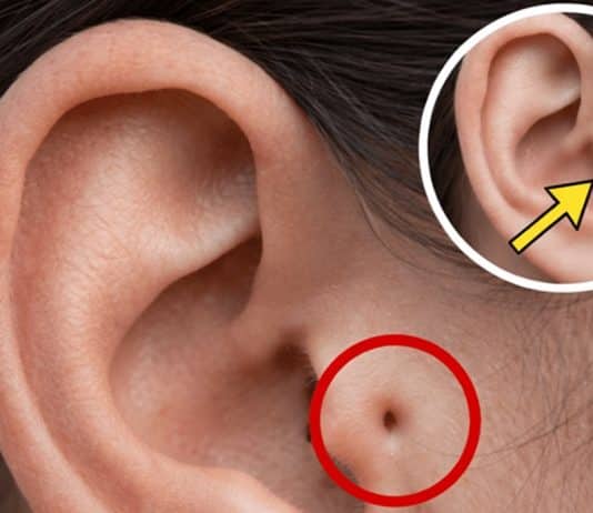 Conhece alguém com esta marca na orelha? O que ela revela pode mudar como você vê essa pessoa Conhece alguém com esta marca na orelha