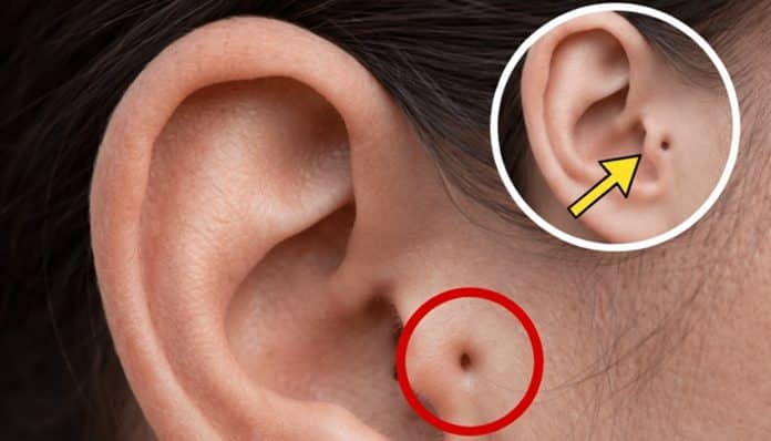 Conhece alguém com esta marca na orelha? O que ela revela pode mudar como você vê essa pessoa