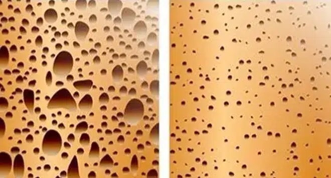 contioutra.com - Voc&ecirc; consome isso com frequ&ecirc;ncia? O impacto nos ossos pode ser maior do que parece