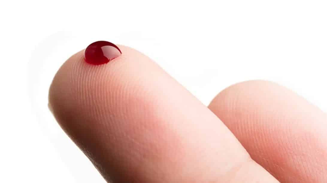 contioutra.com - Evite ataque card&iacute;aco, trombose e derrame: 7 alimentos que destroem os co&aacute;gulos sangu&iacute;neos. O #4 &eacute; vital!
