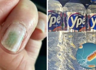 ⚠️ AXILAS, UNHAS E SOLO | Saiba onde a bactéria achada nos produtos Ypê pode se esconder e como ela age