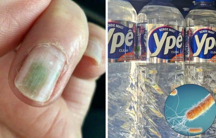 ⚠️ AXILAS, UNHAS E SOLO | Saiba onde a bactéria achada nos produtos Ypê pode se esconder e como ela age