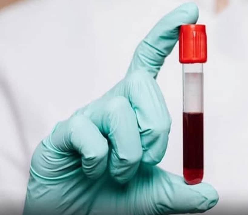 Cientistas revelam: pessoas com este tipo sanguíneo têm o 'gene da longevidade' e vivem mais contioutra.com - Cientistas revelam: pessoas com este tipo sanguíneo têm o 'gene da longevidade' e vivem mais
