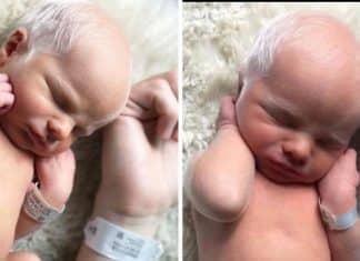 Chamado de “vovô” quando ainda era bebê, ele cresceu e hoje chama atenção por um motivo bem diferente