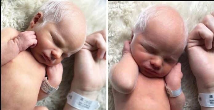 Chamado de “vovô” quando ainda era bebê, ele cresceu e hoje chama atenção por um motivo bem diferente