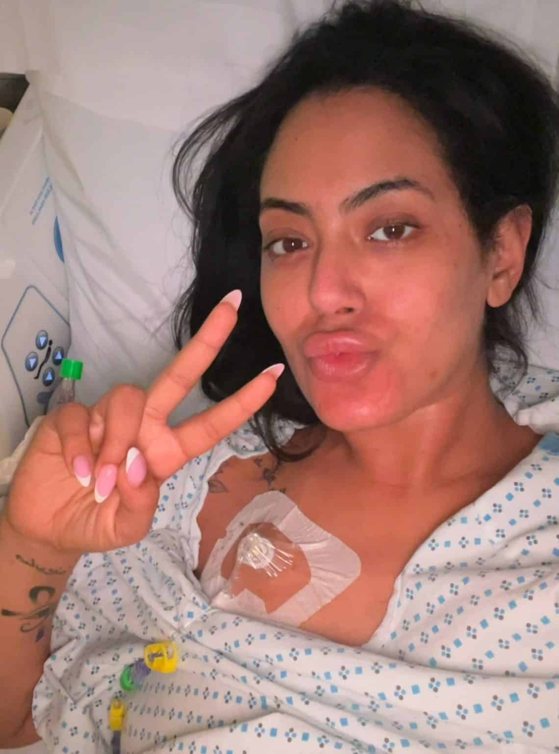 contioutra.com - Mulher ignorou uma dor que parecia vir do suti&atilde; e descobriu um c&acirc;ncer de c&oacute;lon avan&ccedil;ado