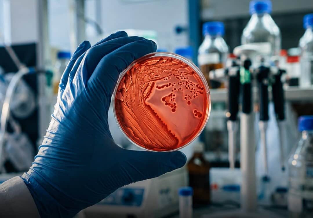 contioutra.com - O alimento comprovado pela ci&ecirc;ncia que elimina 87% dos micropl&aacute;sticos do seu corpo