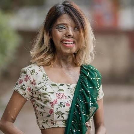 contioutra.com - Ela tinha 2 meses quando o pr&oacute;prio pai jogou &aacute;cido nela; hoje, sua imagem est&aacute; nas passarelas e na Vogue