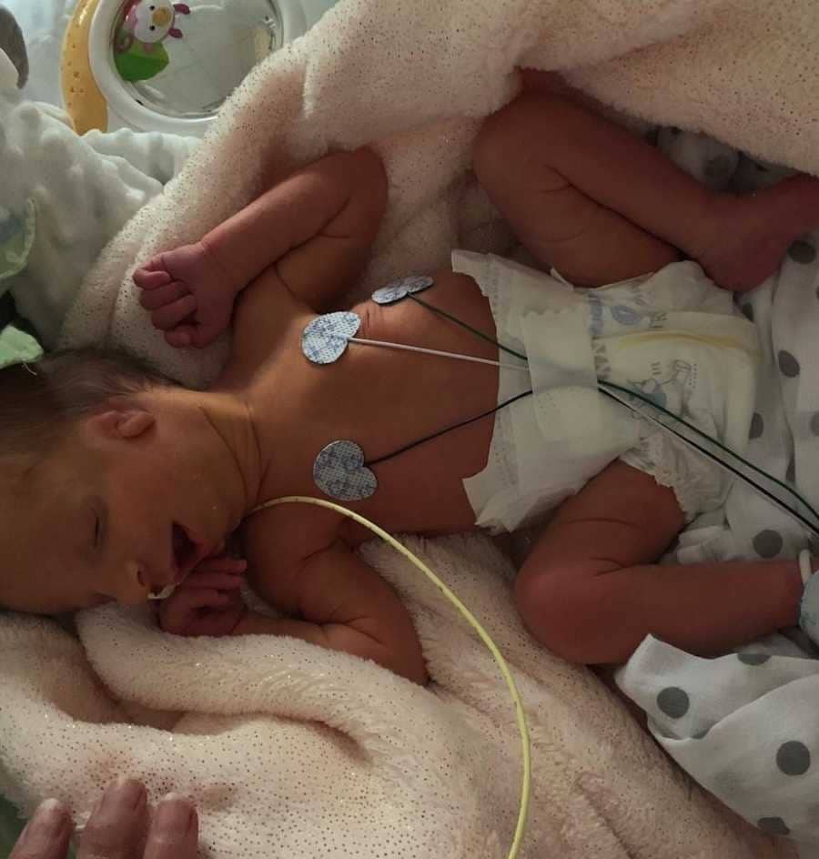 contioutra.com - Ap&oacute;s o parto, o sil&ecirc;ncio na sala fez esta m&atilde;e perceber que algo estava diferente com a filha