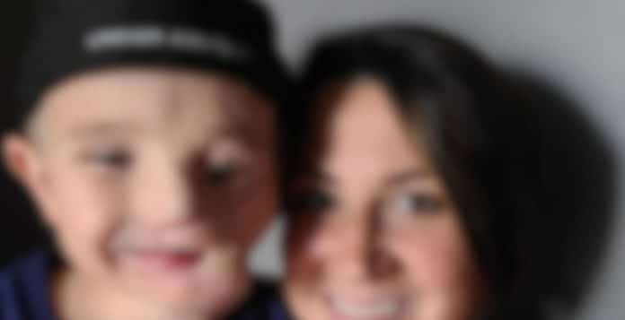 criança 00 Menino de 5 anos sobrevive a ataque brutal de dois cães e é chamado de “monstro” em público