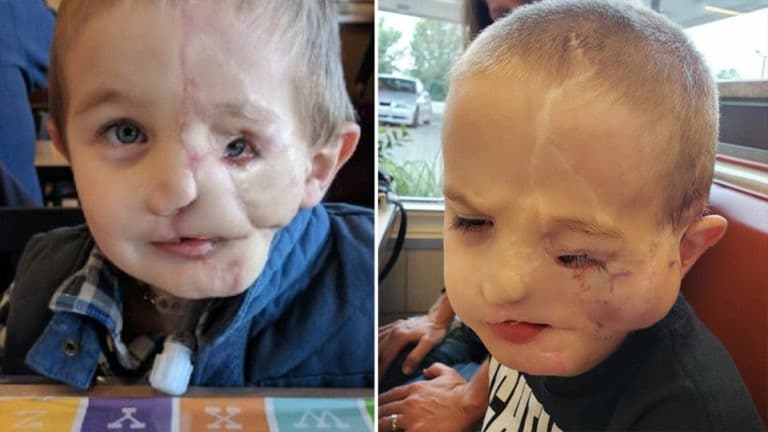 contioutra.com - Menino de 5 anos sobrevive a ataque brutal de dois c&atilde;es e &eacute; chamado de &ldquo;monstro&rdquo; em p&uacute;blico