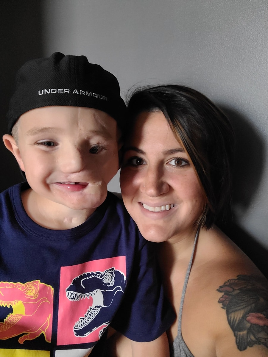 contioutra.com - Menino de 5 anos sobrevive a ataque brutal de dois c&atilde;es e &eacute; chamado de &ldquo;monstro&rdquo; em p&uacute;blico