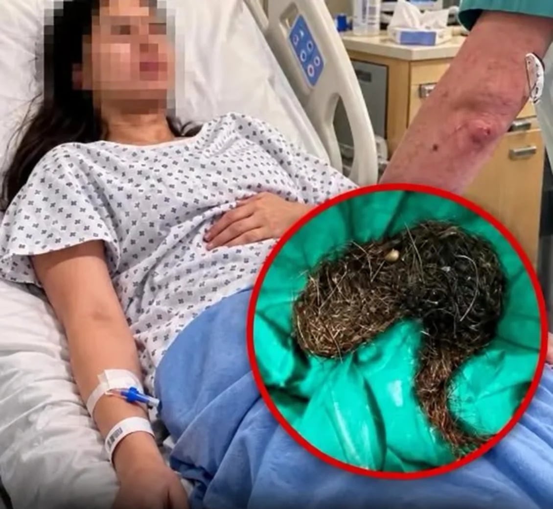 contioutra.com - Durante 6 meses, ela sentiu dor de barriga. O que os m&eacute;dicos suspeitaram &eacute; dif&iacute;cil de imaginar