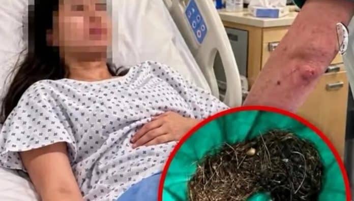Durante 6 meses, ela sentiu dor de barriga. O que os médicos suspeitaram é difícil de imaginar